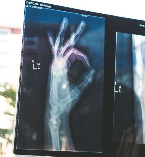 Otros proyectos 04 R (A)